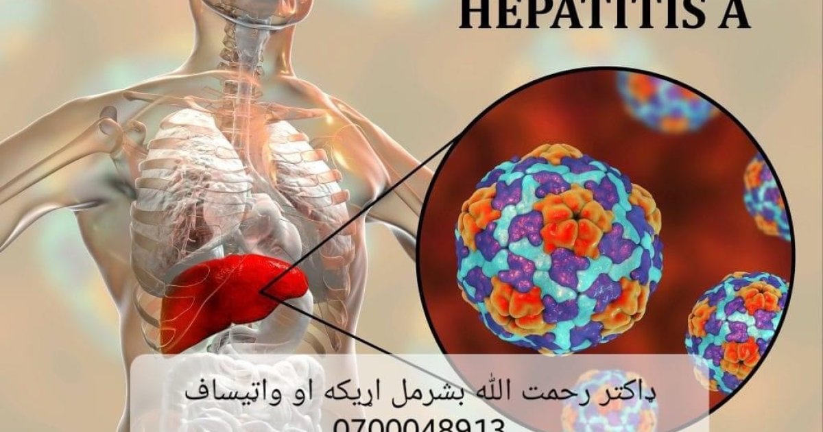 زیړي یو قسم Hepatitis A