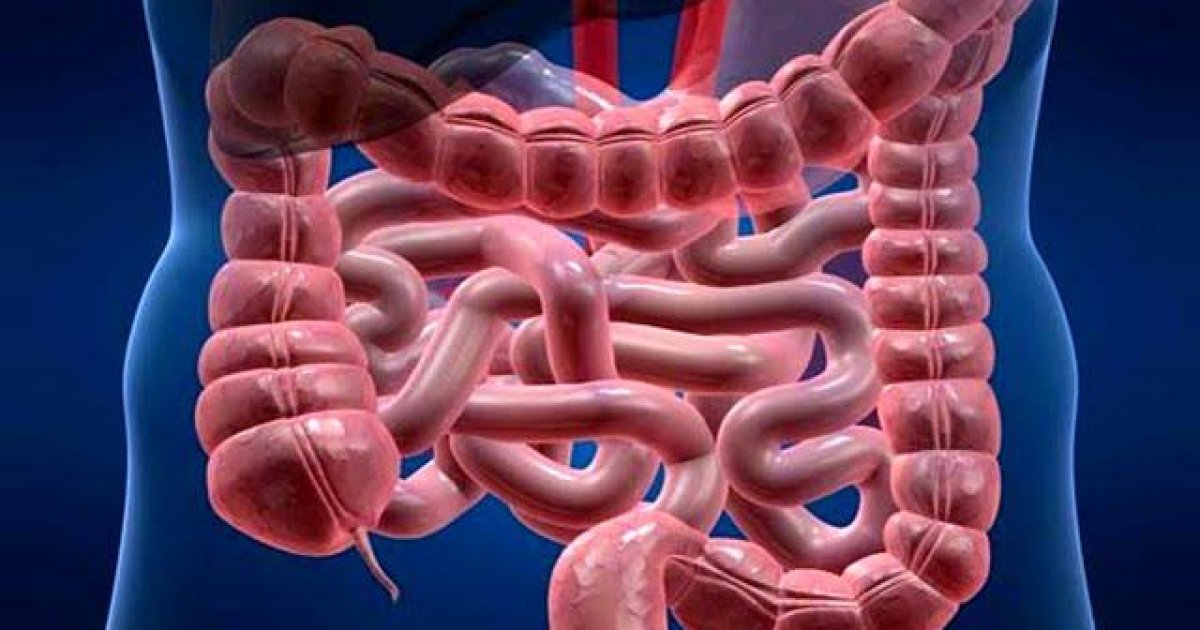 د کولمو د سرطان نښې