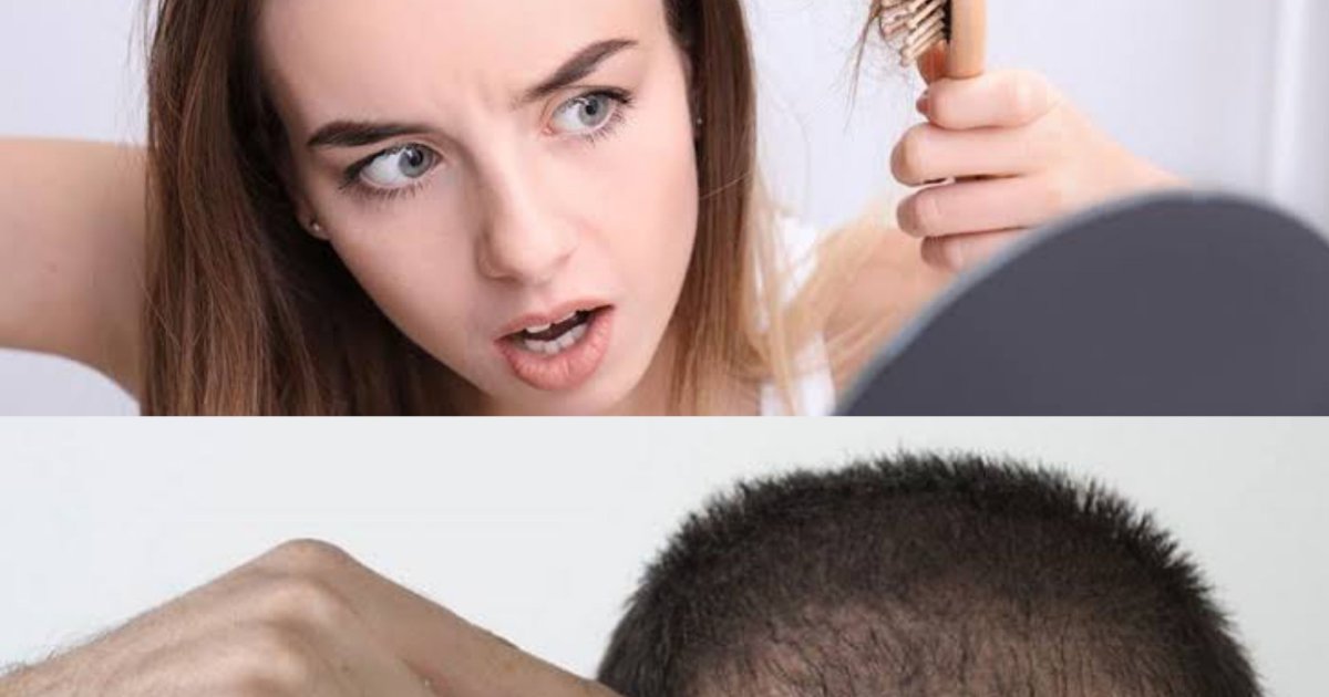 د ويښتانو د وتلو لاملونه