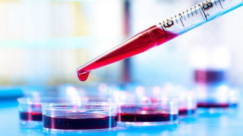 د انیمیا (د وینې د کمښت) مخنیوی