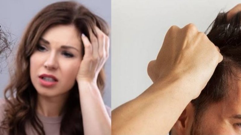  د ويښتانو د وتلو لاملونه