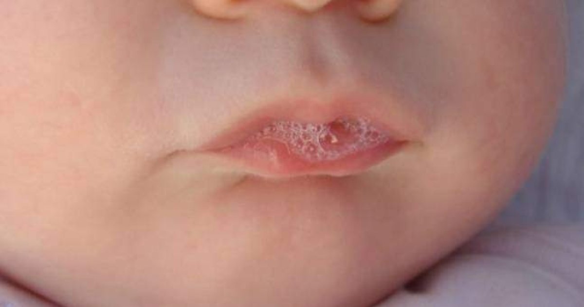 لاړې څه ته ويل کېږي؟